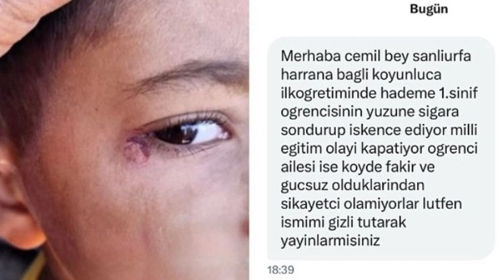 Harran'da Temizlik Görevlisi Öğrenciyi Darp Etti İddiası