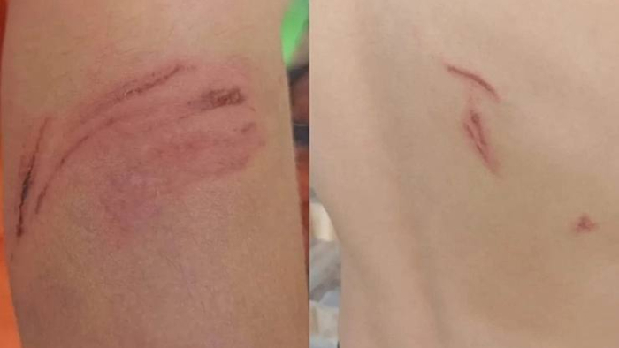 Hilvan’da Sahipsiz Köpek Dehşeti