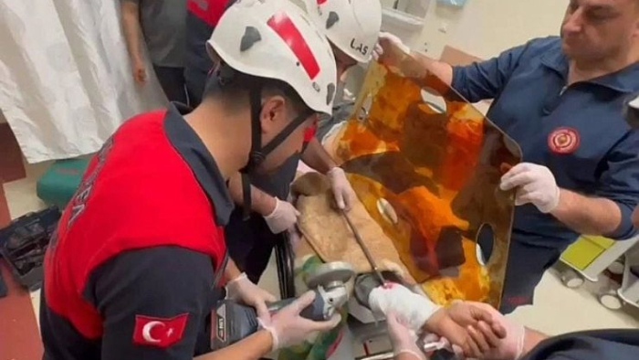 Urfa'da İnşaat Demiri Koluna Saplandı