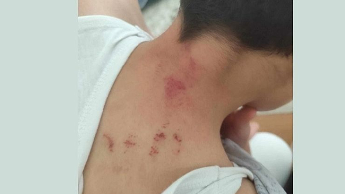 Urfa’da Okulda Şiddet: Öğretmen Tutuklandı