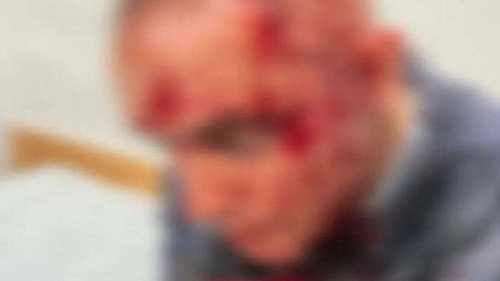 Şanlıurfa’da Zabıta Memuruna Saldırı